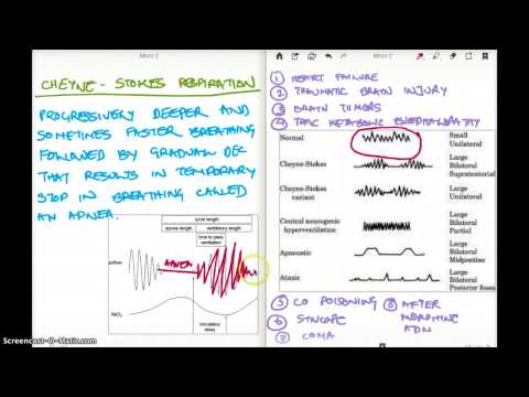 CHEYNE STOKES RESPIRATION