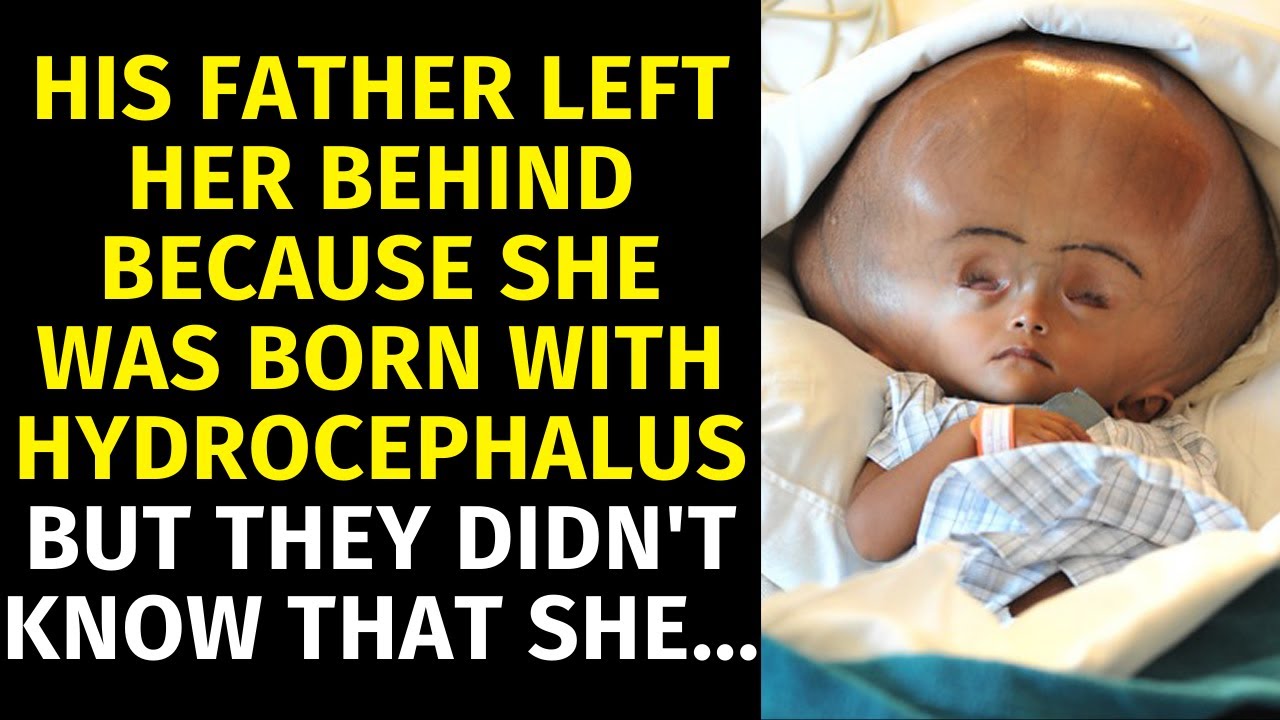 His Father Left Her Behind Because She Was Born With Hydrocephalus But He Didn't Know That She...