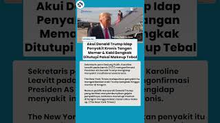 TERKUAK! Gedung Putih Akui Trump Idap Penyakit Kronis, Tangan Memar & Kaki Bengkak, Ditutupi Makeup