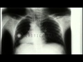 World's first successful motion picture X-ray ...