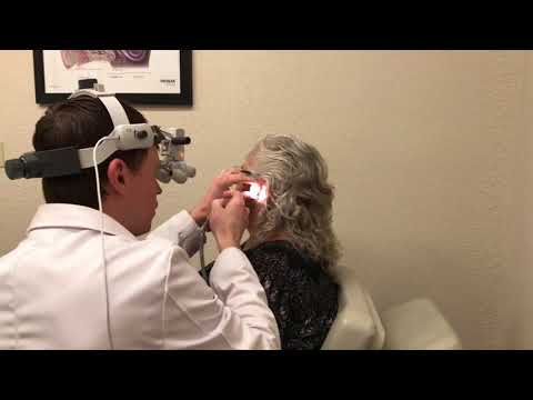 Micro Suction Cerumen (Ear Wax) Removal Procedure