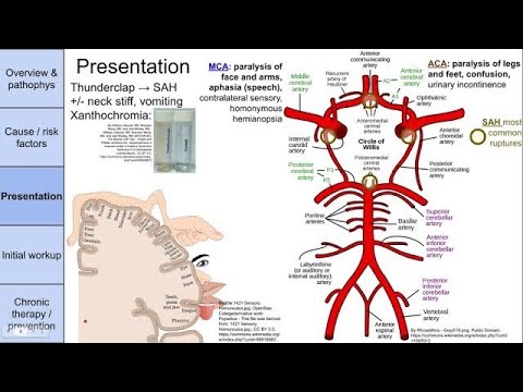 Stroke (cerebrovascular accident, CVA)