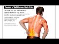 Exercises For Lower Back Pain Part 3