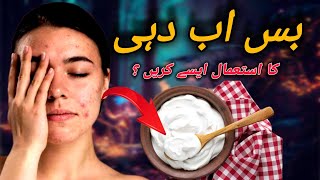 Dark spots on face removal|chehre k daag dhabbe hatane k liye|instant whitening@Beautybasedaaina