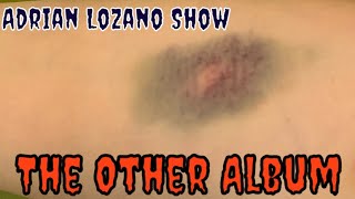 The Other Album