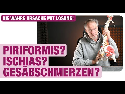 How to properly treat buttock pain – forget the piriformis! Stretching is so yesterday!