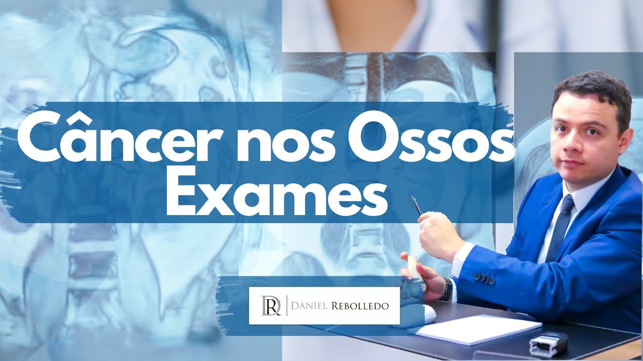 Câncer nos ossos: Quais exames detectam?/ Qual exame diagnostica câncer nos ossos? (2020)