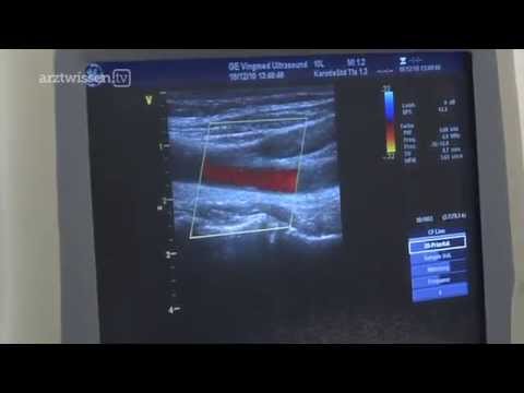 Einige Salbe efektivnost von Rückenschmerzen Gelenkschmerzen bei Arthritis