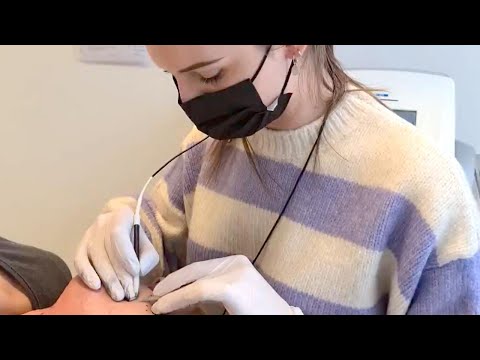 o2 Clinic 💕 What is electrolysis? Electrologist magician Joa at work