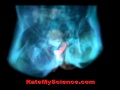 Sex Under MRI Anatomy Of Love Rate My Science