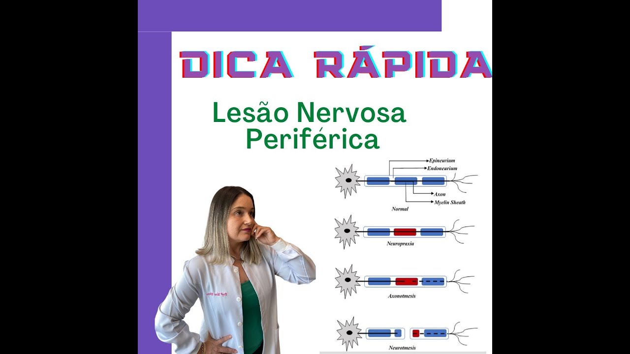 DICA RÁPIDA - LESÃO NERVOSA PERIFÉRICA