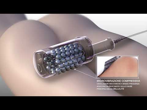 Эндосфера Аппарат для лечения целлюлита и идеального контура тела Endospheres AK Sensor All (Оригинал) - фото 1 - id-p2221160265