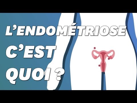 L'endométriose c'est quoi ?