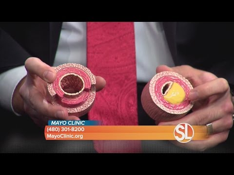 Mayo Clinic discusses cholesterol and the importance of your numbers