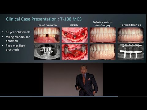An introduction to the Trefoil system by Dr. Kenji Higuchi