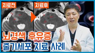 줄기세포 후기