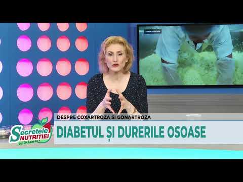 Secretele Nutritiei 24. 06.2020 -  Totul despre cum ne putem păstra mobilitatea