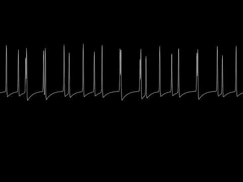 Delek - El Diego (ZX beeper cover, QChan)