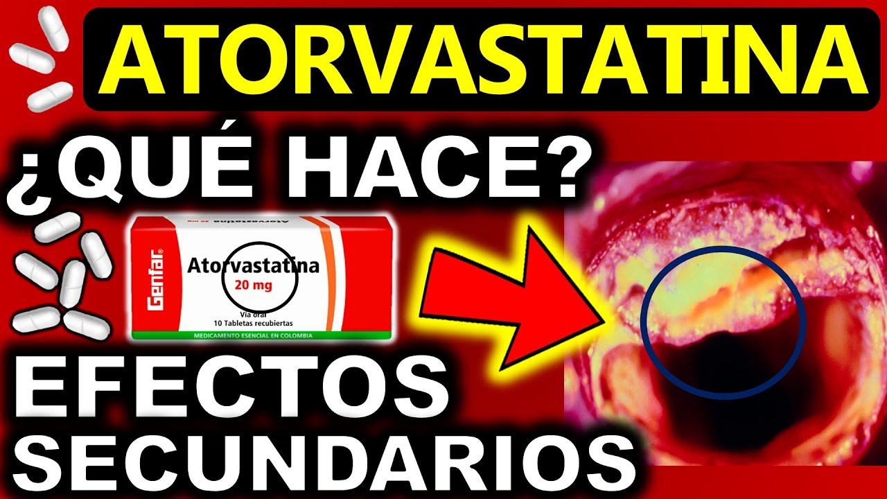 ATORVASTATINA DE 20 MG PARA QUE SIRVE Y EFECTOS SECUNDARIOS | GuiaMed