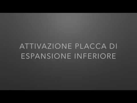 Attivazione placca di espansione inferiore