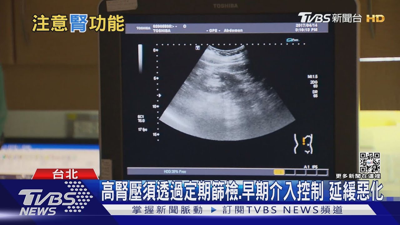 有片/三高族群易併發腎病變 小心第四高疾病輕忽恐終身洗腎!