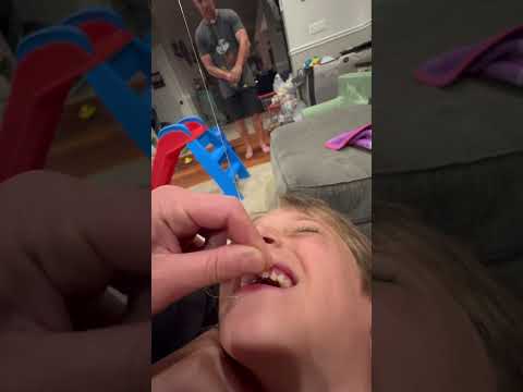 Best way to pull out a tooth! #toothfairy #loosetooth #toothless #insanemullane #pulloutatooth #fish