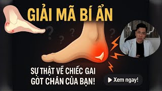 GIẢI MÃ BÍ ẨN VỀ CHIẾC GAI GÓT CHÂN CỦA BẠN! | Sự Thật Về Gai Gót Chân - BS NGUYỄN MINH TẤN