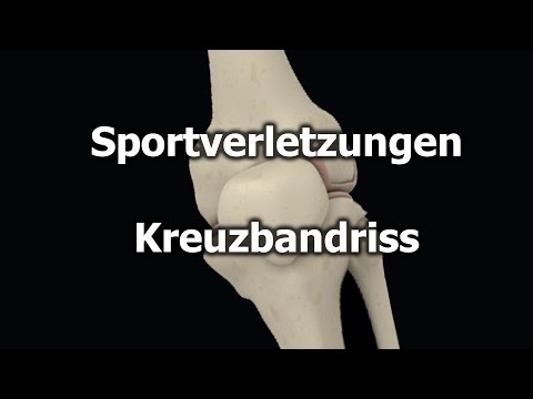 Schmerzen im Bereich der Ferse und Gelenke Analgetikum für Schmerzen in den Gelenken der Salbe