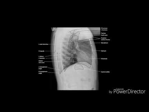 Come migliorare la circolazione sanguigna della testa con trattamento osteocondrosi cervicale Male tutta la colonna vertebrale e le articolazioni