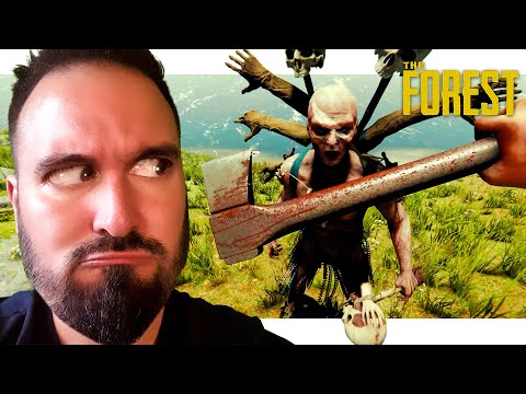 This Forest Survivor Explained the Mystery