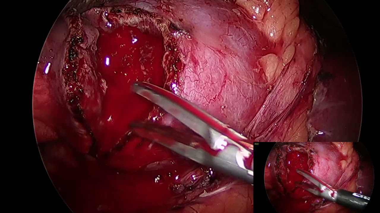 Gustavo Durán Hernández-11