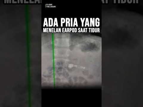 Pria yang Keselek Earpod? #ewinghd #shorts #kisahnyata #misteri