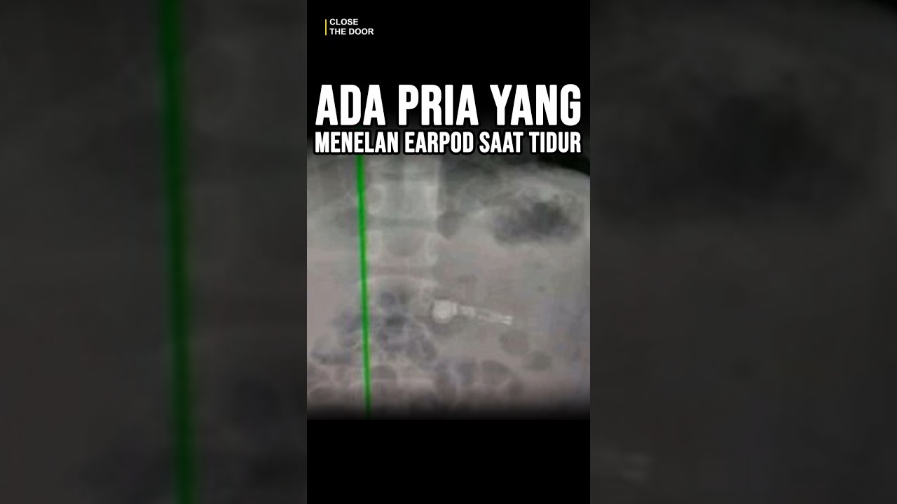 Pria yang Keselek Earpod? #ewinghd #shorts #kisahnyata #misteri