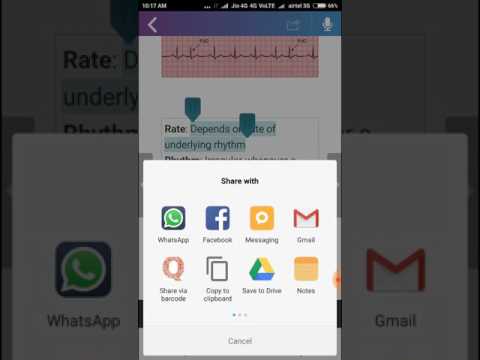 ECG FlashCards - Free Video
