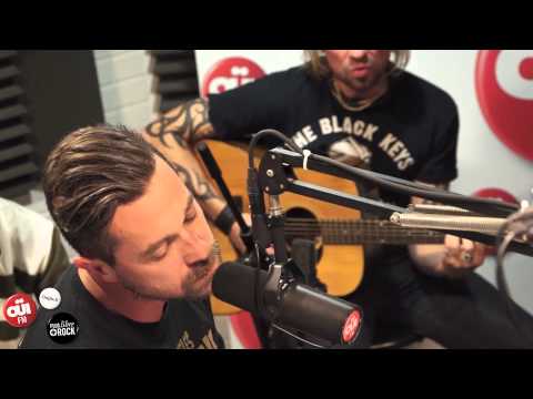Les Fatals Picards - Gros Con - Session Acoustique OÜI FM