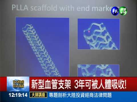 新型血管支架 3年可被人體吸收!