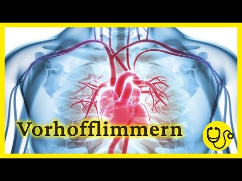 Dr. Nützlich - Vorhofflimmern