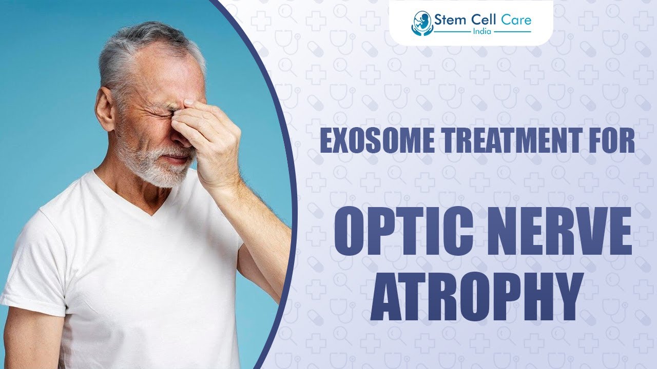 Can Exosome Therapy Help Optic Nerve Atrophy?