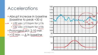 Download lagu Learn OB/GYN: Fetal Heart Rate Monitoring / Nonstress Test mp3