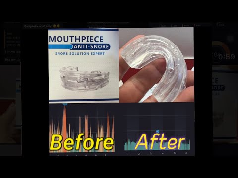 Anti Snore Solution Mouthpiece. does it work?