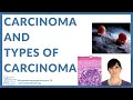 11 What Is CARCINOMA Cancer Education And Research Institute