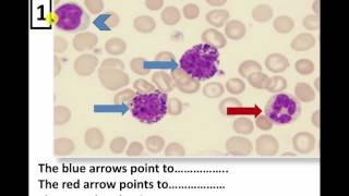 Blood data show revision 2016