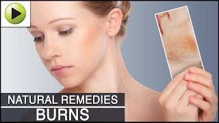 Skin Care - Burns - Natural Ayurvedic Home Remedies