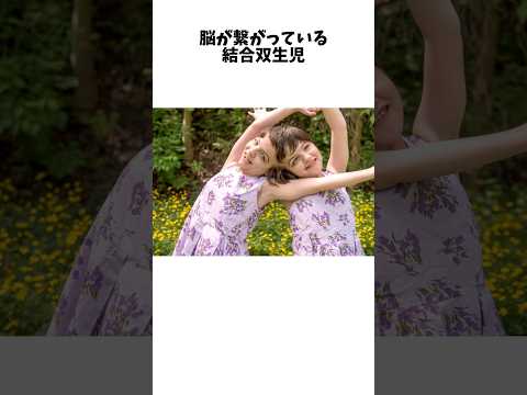 「脳が繋がっている結合双生児」タチアナとクリスタに関する嘘みたいな雑学 #shorts #雑学 #面白い