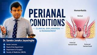 Perianal Conditions