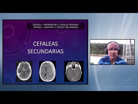 Cefaleas, Generalidades. Dr. José Flores Rivera