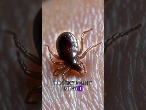 How to Properly Remove a Tick from Your Skin🤔#shorts #facts