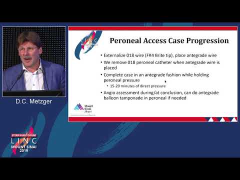 Stern D2 - Peroneal Access Technique - Dr. D. Christopher Metzger