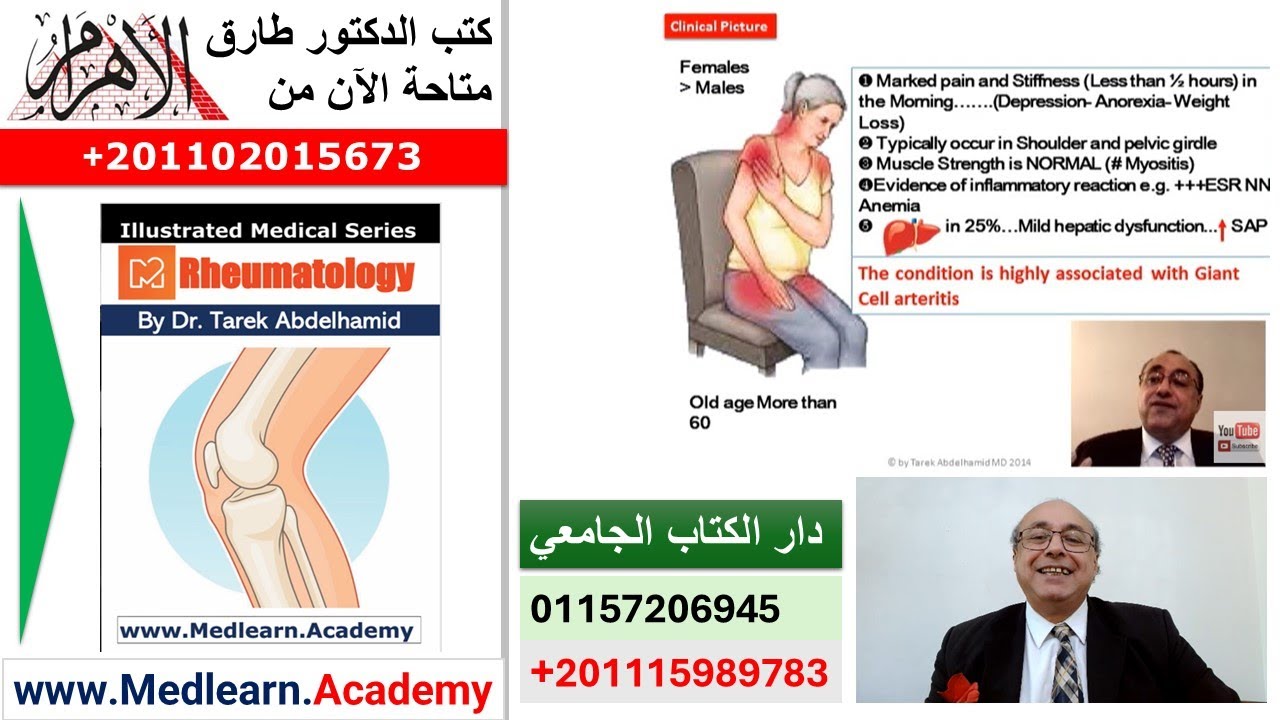 Polymyalgia Rheumatica (PMR) #cme #internal_medicine #usmle #medicalschool   #medical #محاضرات_باطنة