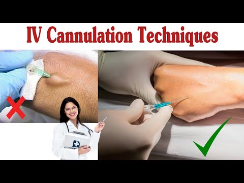 IV Cannula Colour And Size Cannula Types And Uses